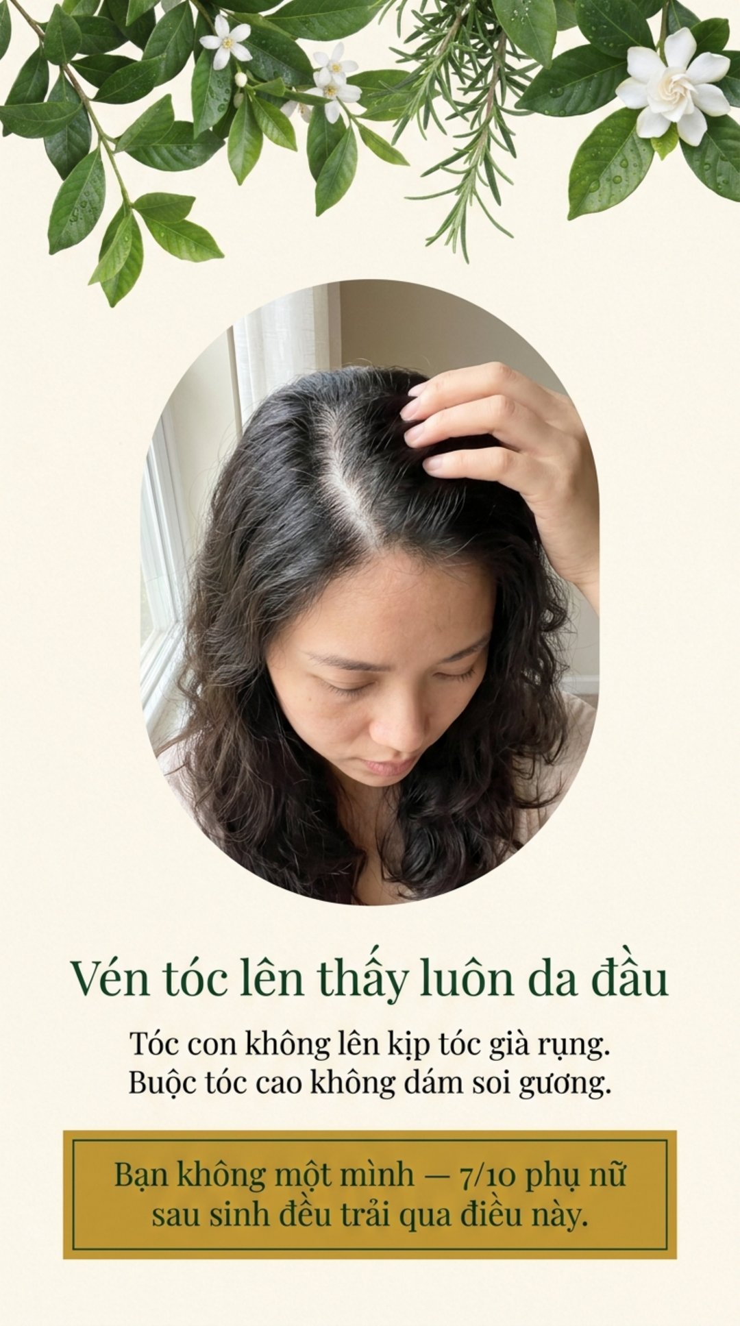 Pain - rụng tóc sau sinh